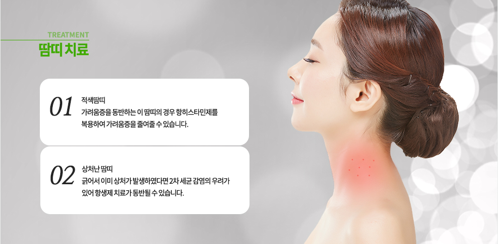 땀띠 치료
적색땀띠 : 가려움증을 동반하는 이 땀띠의 경우 항히스타민제를 복용하여 가려움증을 줄여줄 수 있습니다.
상처난 땀띠 : 긁어서 이미 상처가 발생하였다면 2차 세균 감염의 우료가 있어 항생제 치료가 동반될 수 있습니다.
