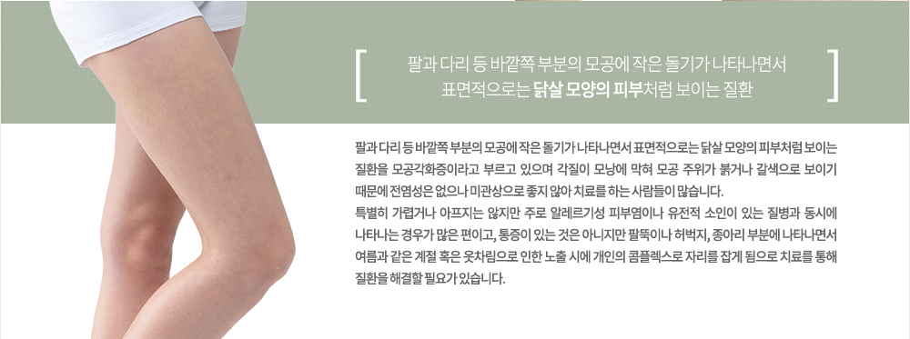 특징 및 원인
팔과 다리 등 바깥쪽 부분의 모공에 작은 돌기가 나타나면서 표면적으로는 닭살 모양의 피부처럼 보이는 질환을 모공각화증이라고 부르고 있으며 각질이 모낭에 막혀 모공 주위가 붉거나 갈색으로 보이기 때문에 전염성은 없으나 미관상으로 좋지 않아 치료를 하는 사람들이 많습니다.
특별히 가렵거나 아프지는 않지만 주로 알레르기성 피부염이나 유전적 소인이 있는 질병과 동시에 나타나는 경우가 많은 편이고, 통증이 있는 것은 아니지만 팔뚝이나 허벅지, 종아리 부분에 나타나면서 여름과 같은 계절 혹은 옷차림으로 인한 노출 시에 개인의 콤플렉스로 자리를 잡게 됨으로 치료를 통해 질환을 해결할 필요가 있습니다. 
