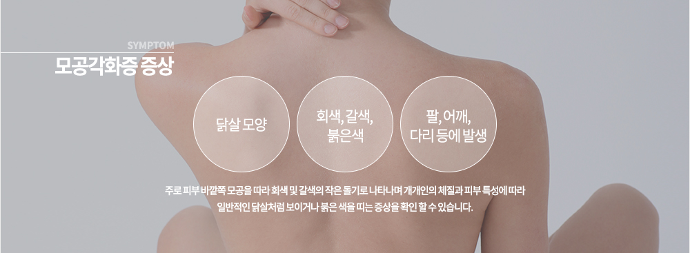 모공각화증 증상
▶ 팔, 어깨, 다리
주로 피부 바깥쪽 모공을 따라 회색 및 갈색의 작을 돌기로 나타나며 개개인의 체질과 피부 특성에 따라 일반적인 닭살처럼 보이거나 붉은 색을 띠는 증상을 확인 할 수 있습니다.
