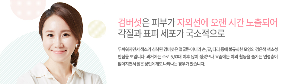 검버섯
피부가 자외선에 오랜 시간 노출되어 각질과 표피 세포가 국소적으로 두꺼워지면서 색소가 침착된 검버섯은 얼굴뿐 아니라 손, 팔, 다리 등에 불규칙한 모양의 검은색 색소성 반점을 보입니다.
과거에는 주로 5,60대 이후 많이 생겼으나 요즘에는 야외 활동을 즐기는 연령층이 많아지면서 젊은 성인에게도 나타나는 경우가 있습니다.
