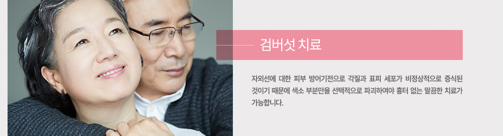 치료
자외선에 대한 피부 방어기전으로 각질과 표피 세포가 비정상적으로 증식된 것이기 때문에 색소 부분만을 선택적으로 파괴하여야 흉터 없는 말끔한 치료가 가능합니다.
