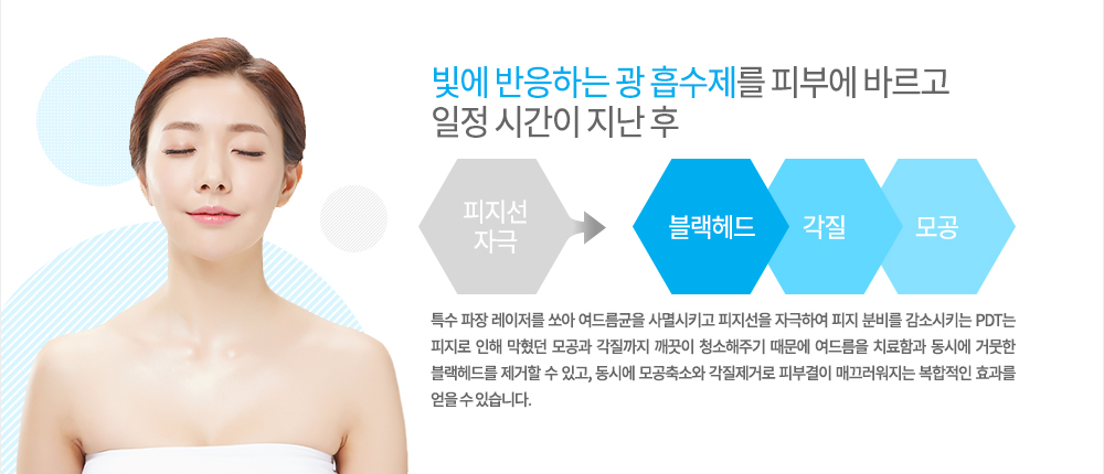 원리
빛에 반응하는 광 흡수제를 피부에 바르고 일정 시간이 지난 후 특수 파장 레이저를 쏘아 여드름균을 사멸시키고 피지선을 자극하여 피지 분비를 감소시키는 PDT는 피지로 인해 막혔던 모공과 각질까지 깨끗이 청소해주기 때문에 여드름을 치료함과 동시에 거뭇한 블랙헤드를 제거할 수 있고, 동시에 모공축소와 각질제거로 피부결이 매끄러워지는 복합적인 효과를 얻을 수 있습니다.
