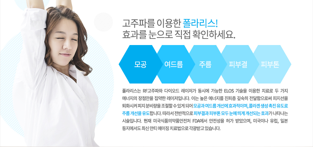 -특징
폴라리스는 RF고주파와 다이오드 레이저가 동시에 가능한 ELOS 기술을 이용한 치료로 두 가지 에너지의 장점만을 집약한 레이저입니다. 이는 높은 에너지를 진피층 깊숙히 전달함으로써 피지선을 퇴화시켜 피지 분비량을 조절할 수 있게 되어 모공과 여드름 개선에 효과적이며, 콜라겐 생성 촉진 유도로 주름 개선을 유도합니다. 따라서 전반적으로 피부결과 피부톤 모두 눈에 띄게 개선되는 효과가 나타나는 시술입니다. 현재 미국식품의약품안전처 FDA에서 안전성을 허가 받았으며, 미국이나 유럽, 일본 등지에서도 최신 안티 에이징 치료법으로 각광받고 있습니다.
